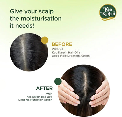 Keo Karpin Olive & Vitamin E Non-Sticky Hair Oil (300ml / 500ml)